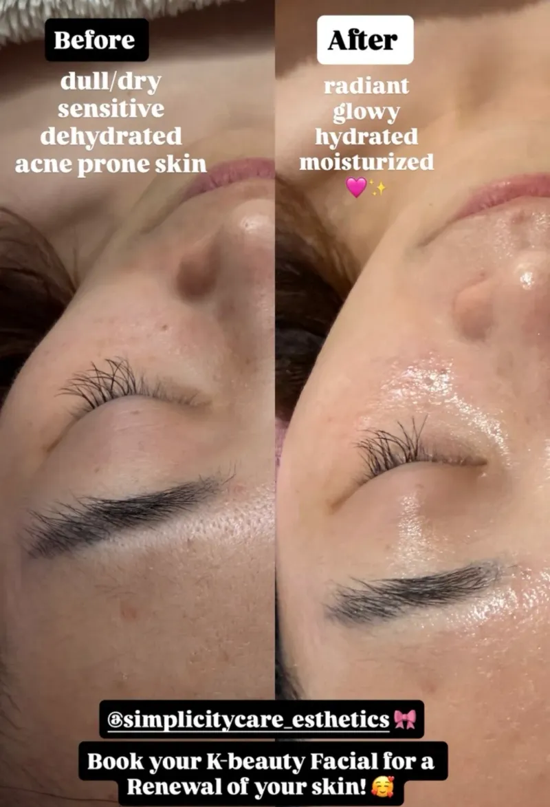 Customized K-Beauty Facial