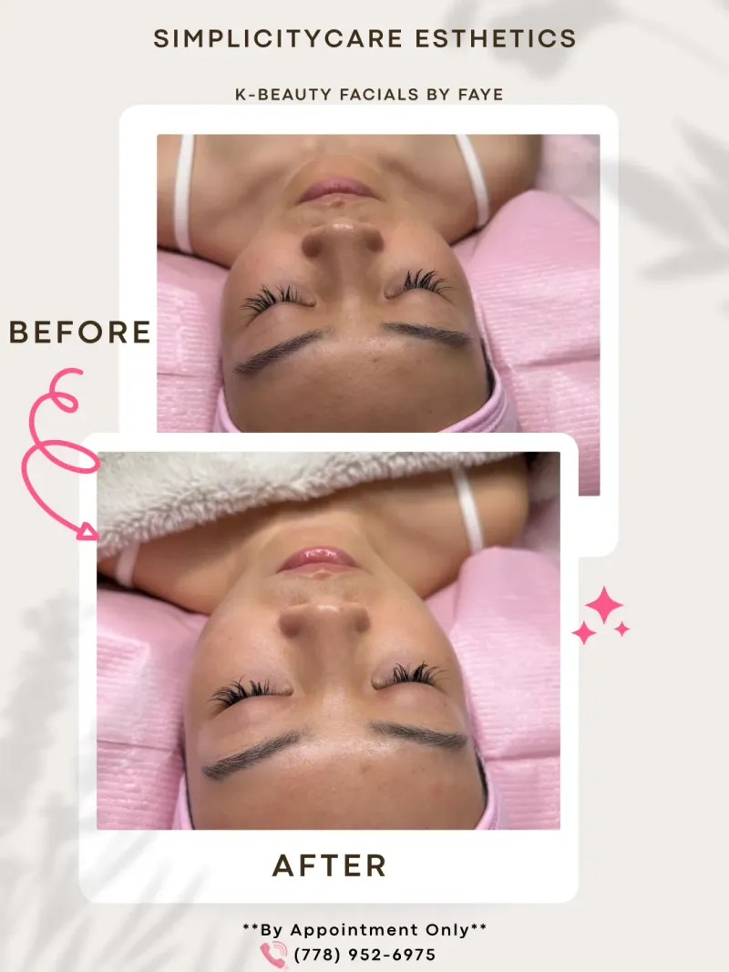 K-Beauty Hydro Facial