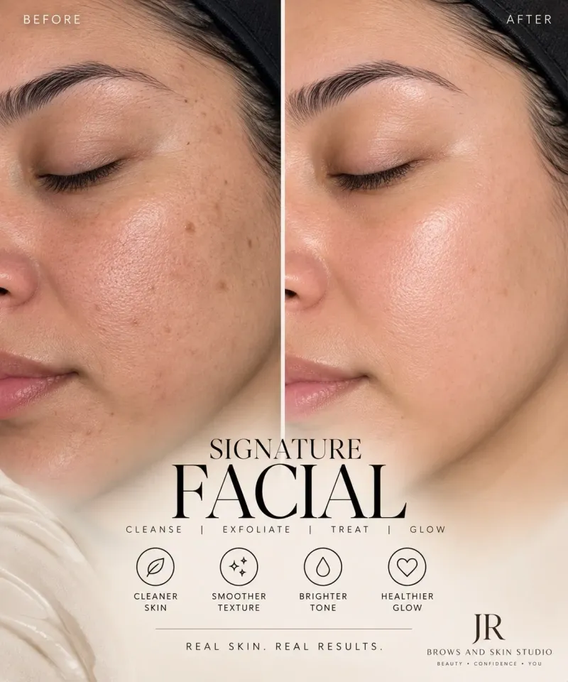 Customize facials
