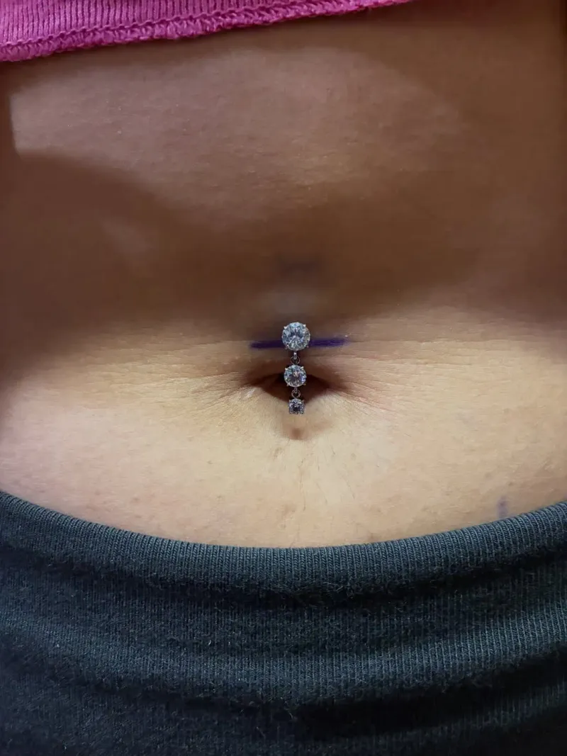 Navel