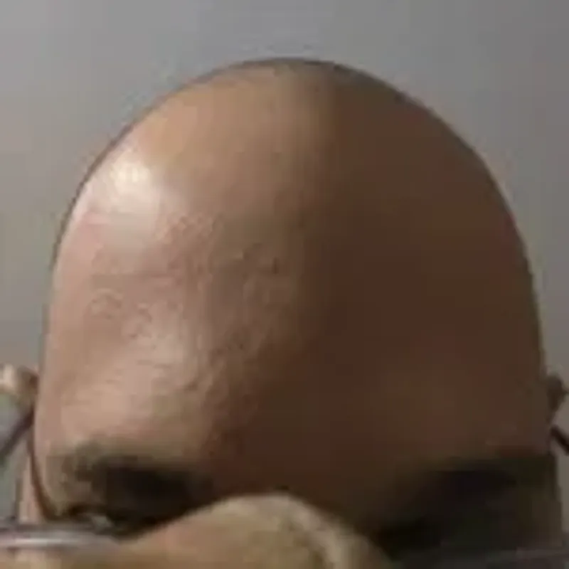 baldguyhere